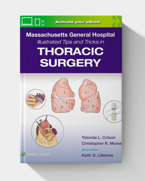 Massachusetts General Hospital Illustrated Tips and Tricks in Thoracic Surgery (1st Edition) (PDF ONLY)