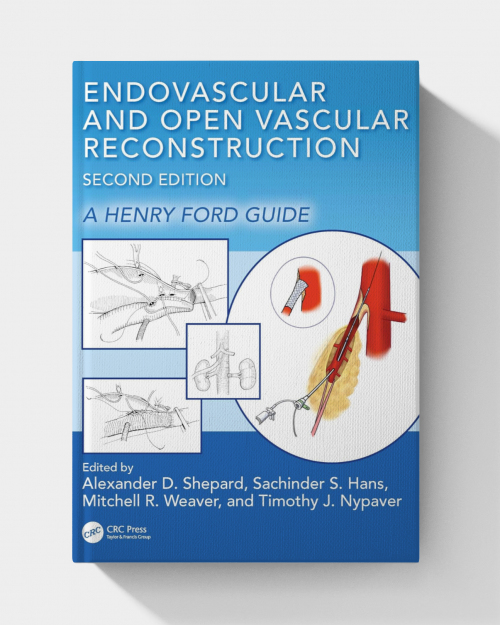Endovascular and Open Vascular Reconstruction: A Henry Ford Surgical Guide (2nd Edition) 2025