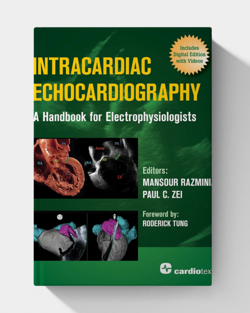Intracardiac Echocardiography: A Handbook for Electrophysiologists (PDF ONLY)
