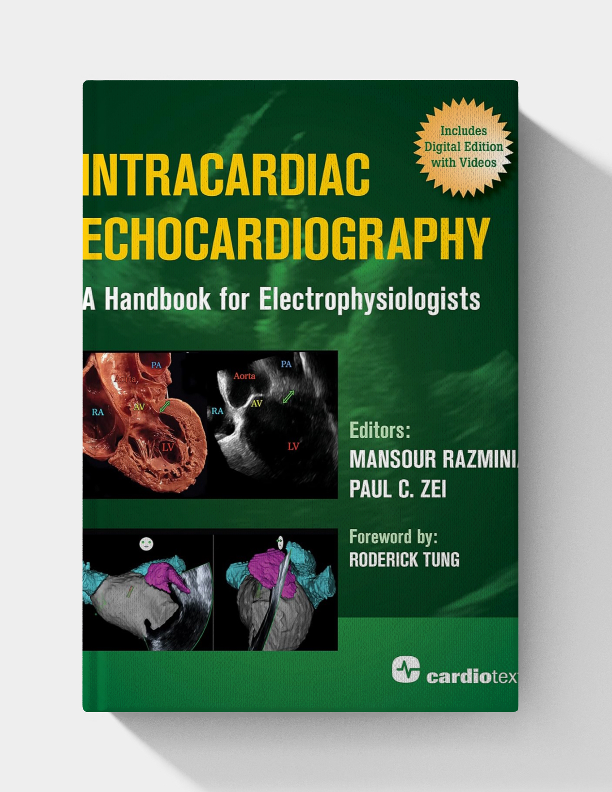 Intracardiac Echocardiography: A Handbook for Electrophysiologists (PDF ONLY)