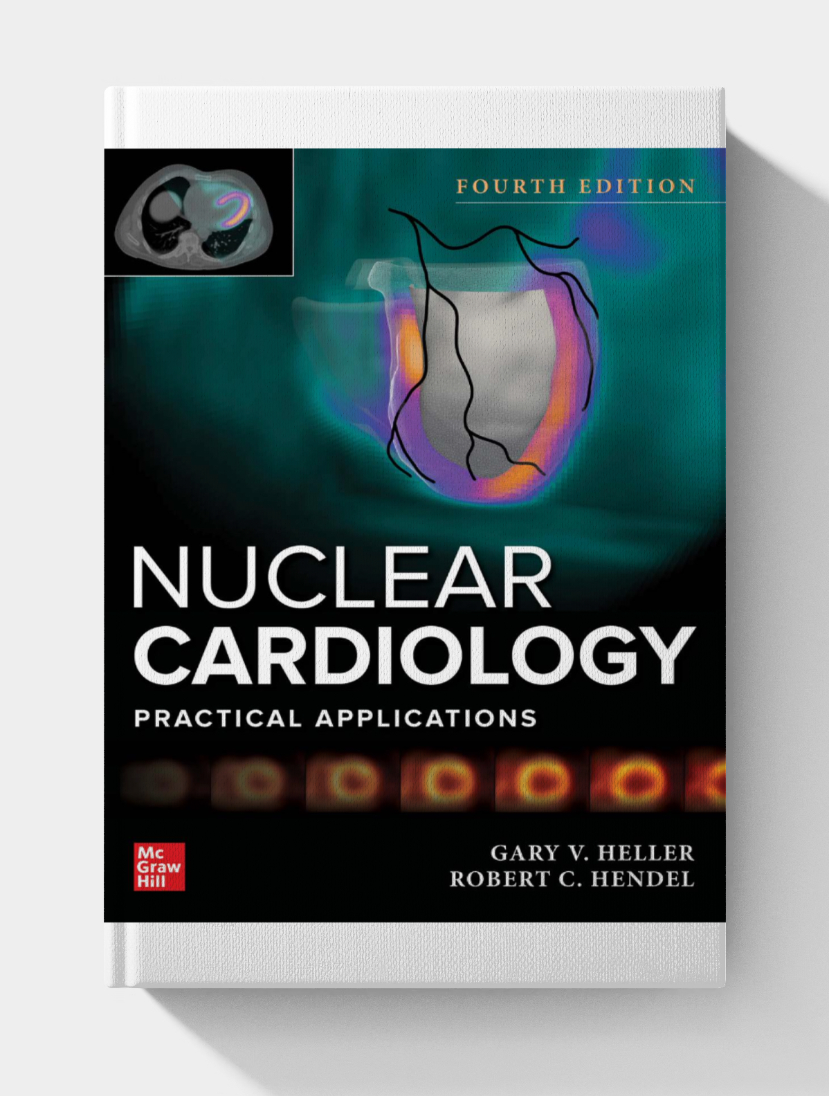 Nuclear Cardiology: Practical Applications (4th Edition)