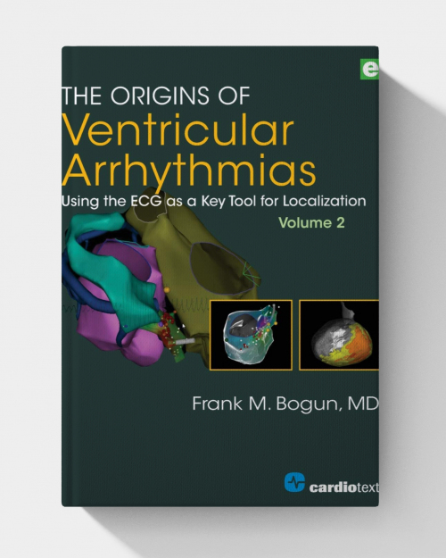 The Origins of Ventricular Arrhythmias, Volume 2 (1st Edition)