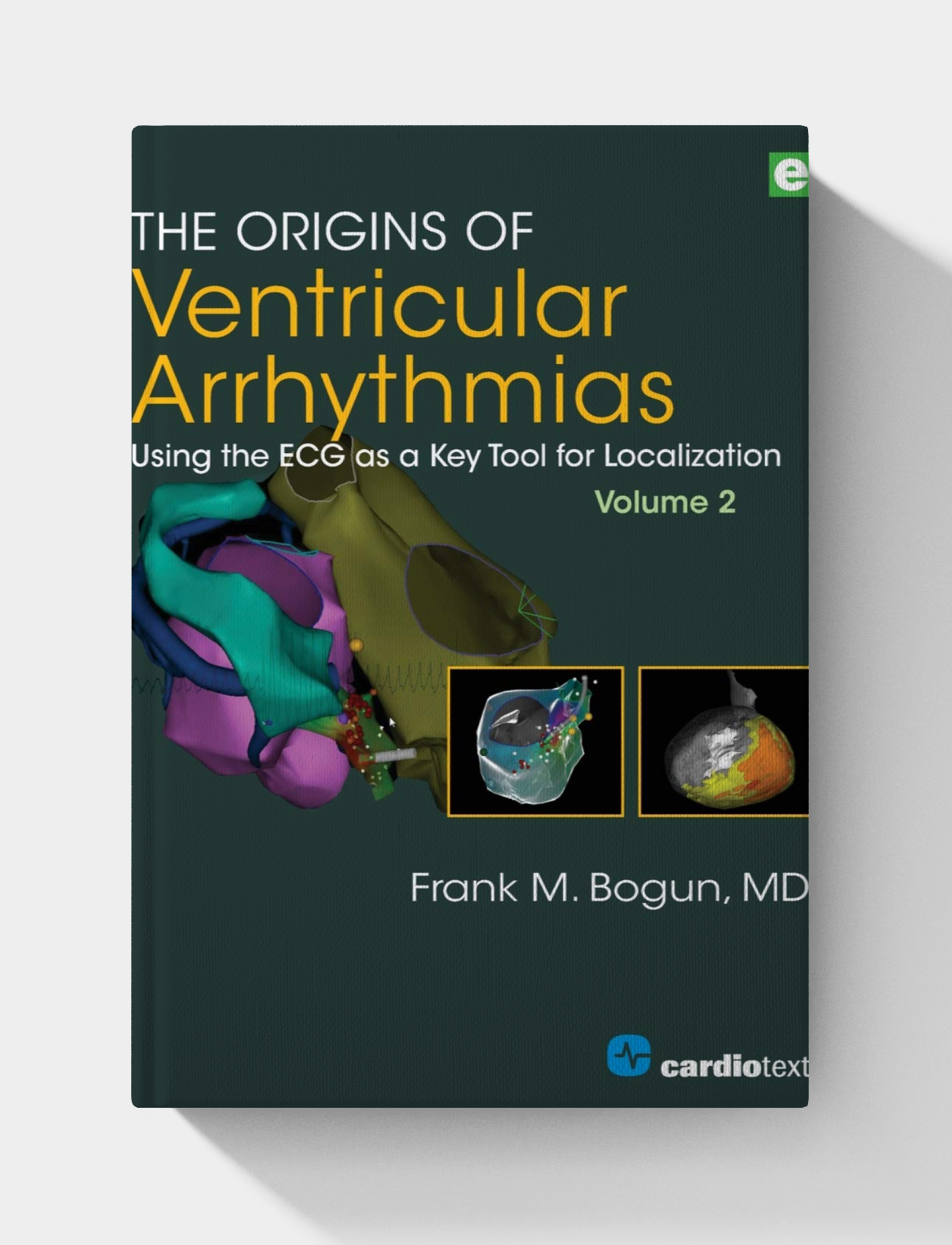 The Origins of Ventricular Arrhythmias, Volume 2 (1st Edition)