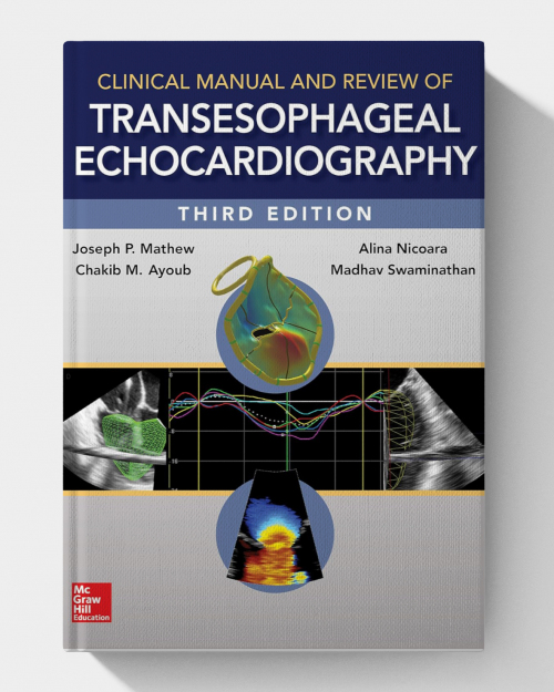 Clinical Manual and Review of Transesophageal Echocardiography (3rd Edition)