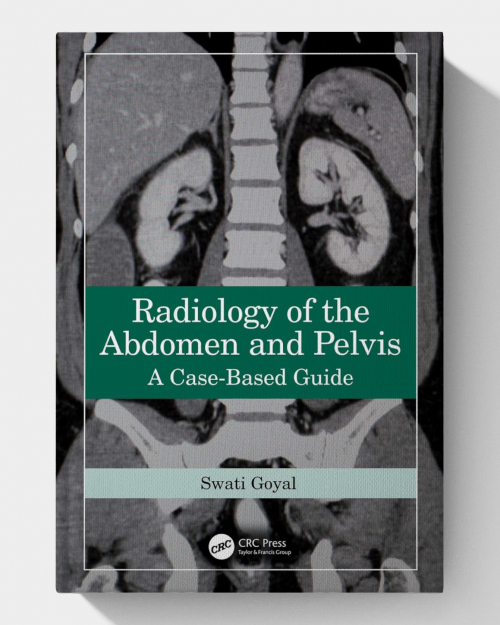 Radiology of the Abdomen and Pelvis: A Case-Based Guide (1st Edition) 2024