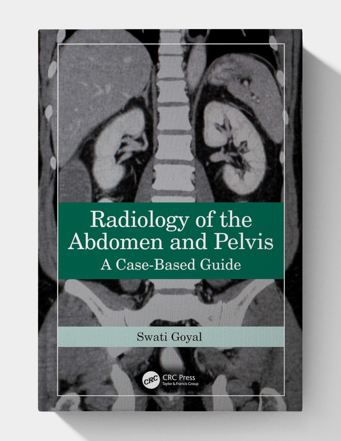 Radiology of the Abdomen and Pelvis: A Case-Based Guide (1st Edition) 2024