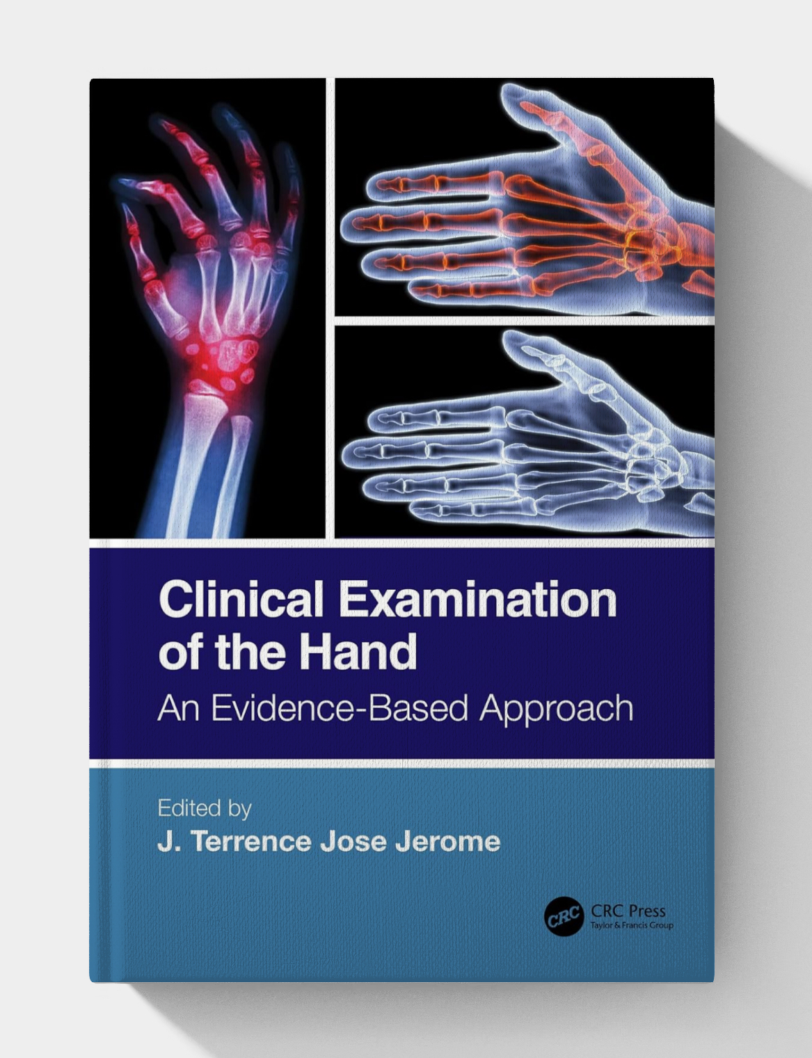 Clinical Examination of the Hand: An Evidence-Based Approach