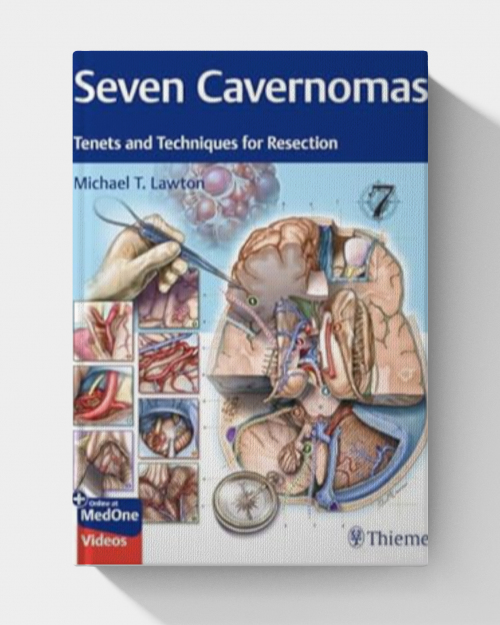 Seven Cavernomas: Tenets and Techniques for Resection