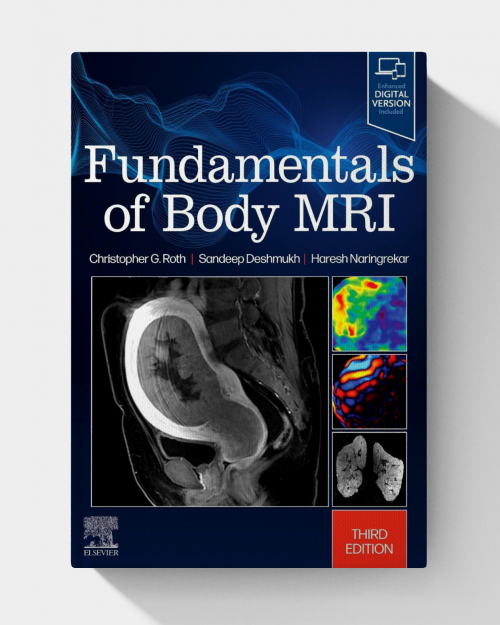 Fundamentals of Body MRI (Fundamentals of Radiology), 3rd edition 2024