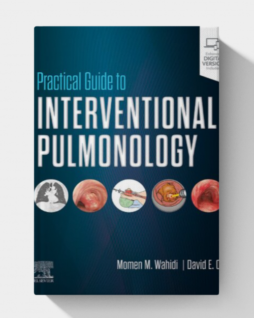 Practical Guide to Interventional Pulmonology (1st Edition)