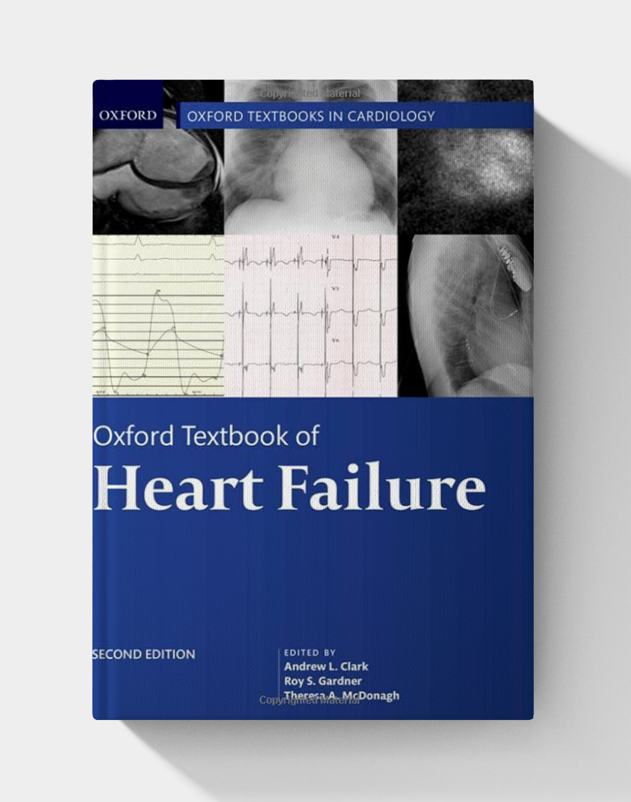 Oxford Textbook of Heart Failure (Oxford Textbooks in Cardiology)  (2nd Edition)