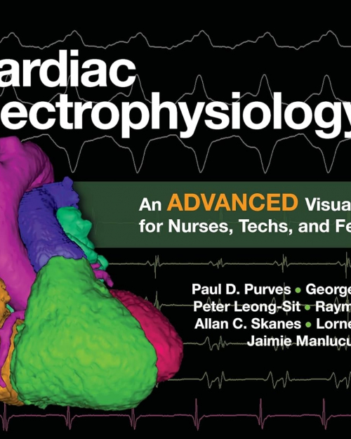 Cardiac Electrophysiology 2: An Advanced Visual Guide for Nurses, Techs, and Fellows