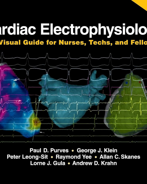 Cardiac Electrophysiology: A Visual Guide for Nurses, Techs, and Fellows (2nd Edition) PDF ONLY