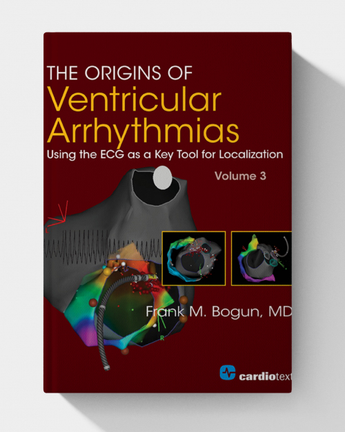 The Origins of Ventricular Arrhythmias: Using the ECG as a Key Tool for Localization, Volume 3
