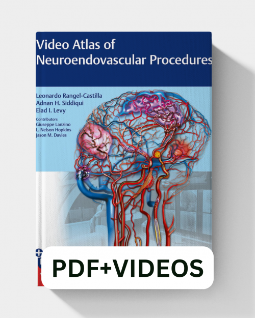Videos Atlas of Neuroendovascular Procedures (1st Edition)