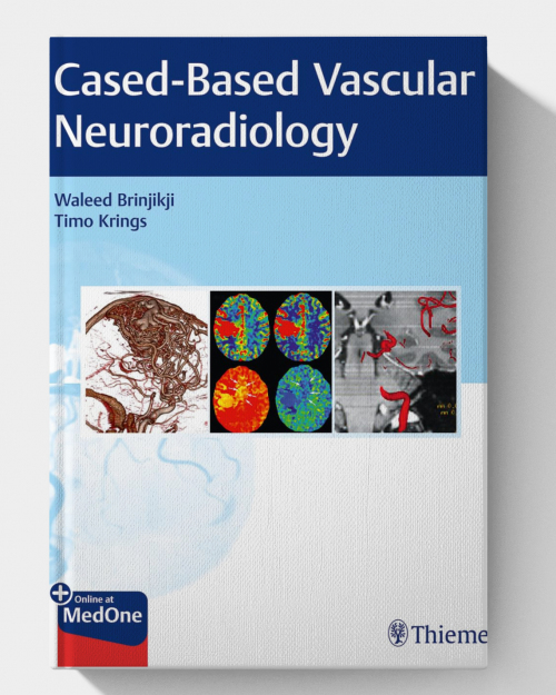 Imaging in Neurovascular Disease: A Case-Based Approach (1st Edition)