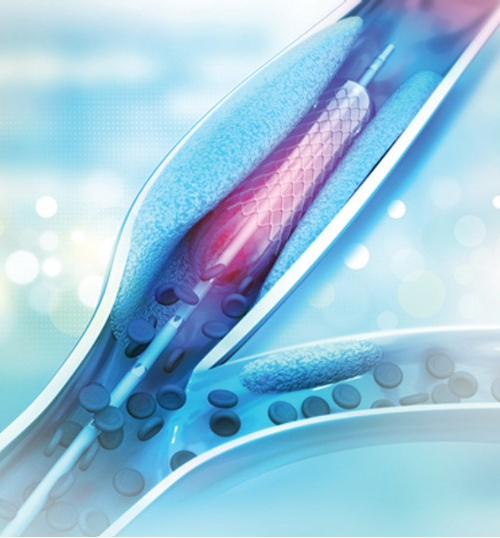 Comprehensive Review and" Update of What’s New in Vascular and Endovascular Surgery 2023 (Videos)
