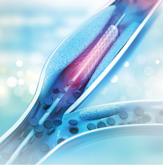 Comprehensive Review and" Update of What’s New in Vascular and Endovascular Surgery 2023 (Videos)