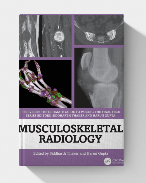 Musculoskeletal Radiology: An Ultimate Guide to Passing the Final FRCR (FRCRverse)