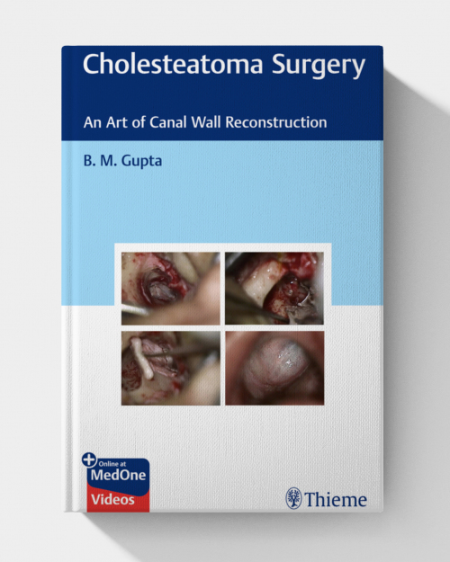 Cholesteatoma Surgery: An Art of Canal Wall Reconstruction