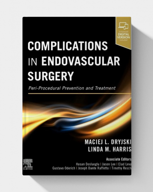 Complications in Endovascular Surgery: Peri-Procedural Prevention and Treatment (1st Edition)