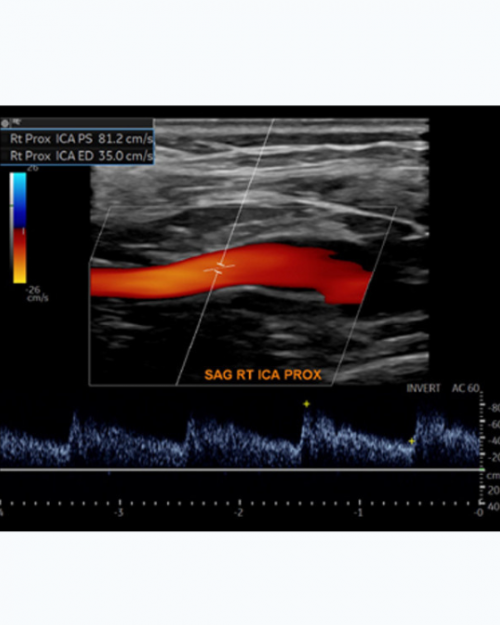 Society for Vascular Medicine Comprehensive Review of Vascular Ultrasound Interpretation and Registry Preparation 2023