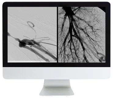 ARRS Case Review of Vascular and Interventional Radiology 2023 (Videos)