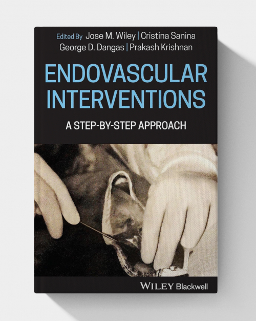 Endovascular Interventions: A Step-by-Step Approach (1st Edition)