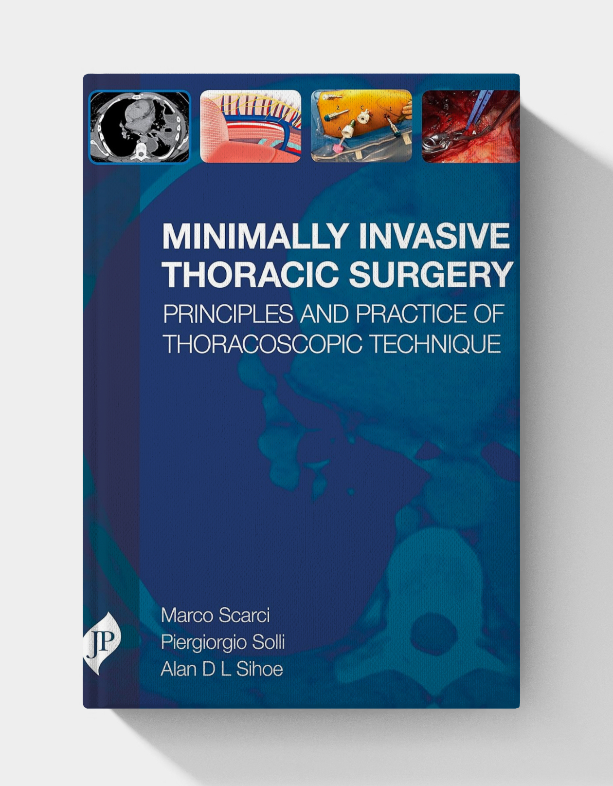 Minimally Invasive Thoracic Surgery: Principles and Practice of Thoracoscopic Technique (1st Edition)