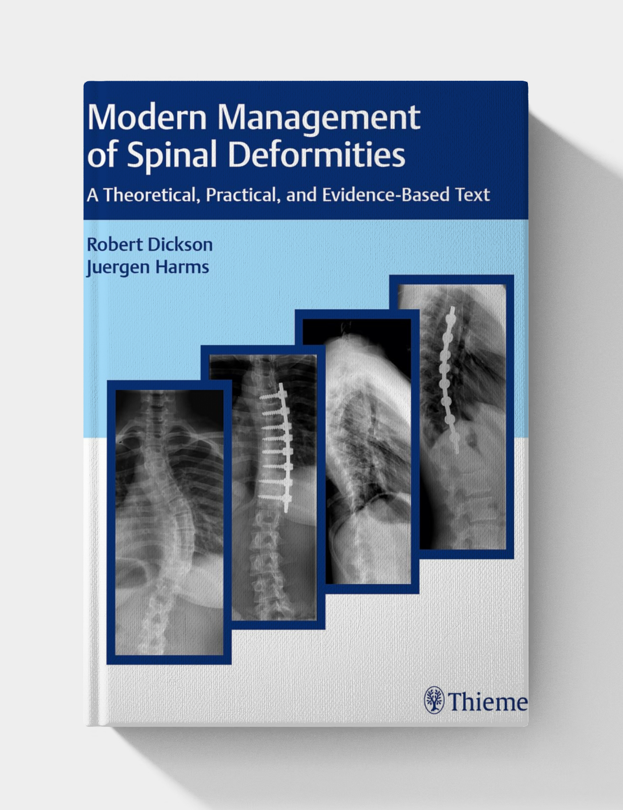 Modern Management of Spinal Deformities (1st Edition)