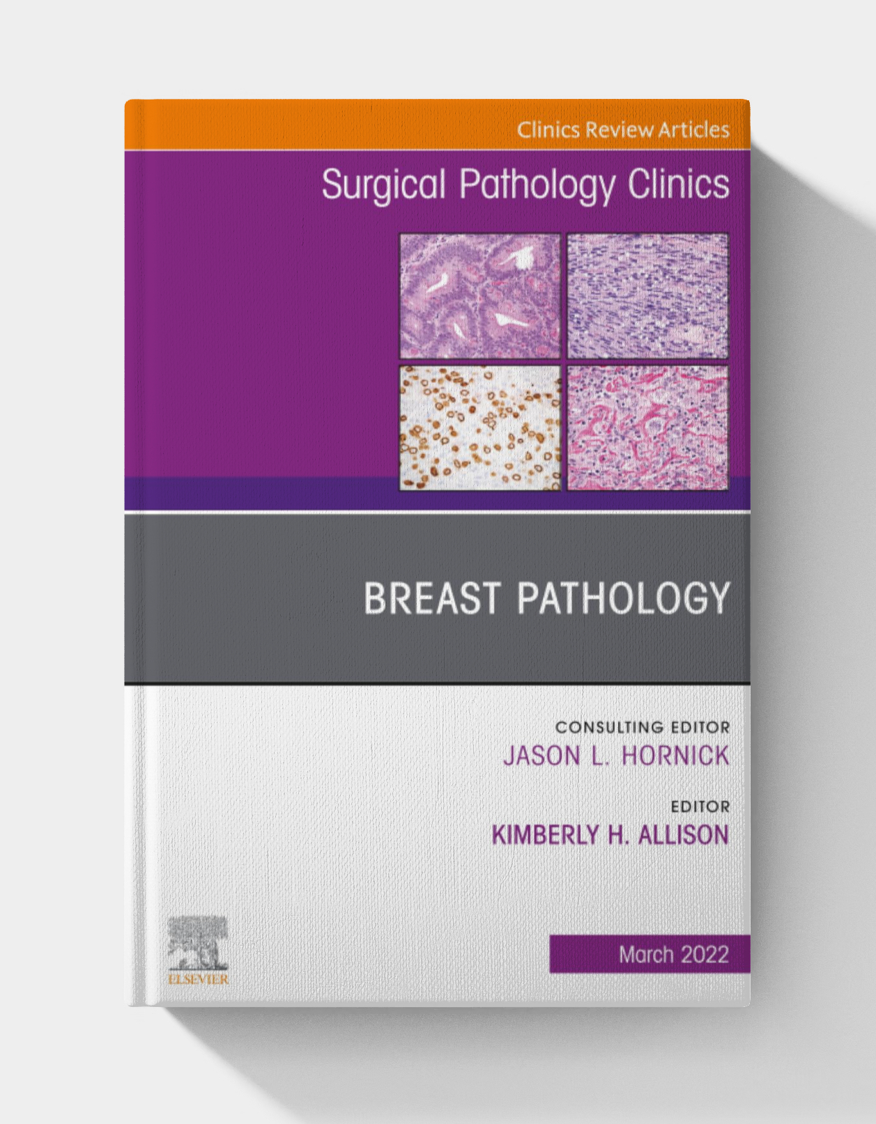 Breast Pathology, An Issue of Surgical Pathology Clinics