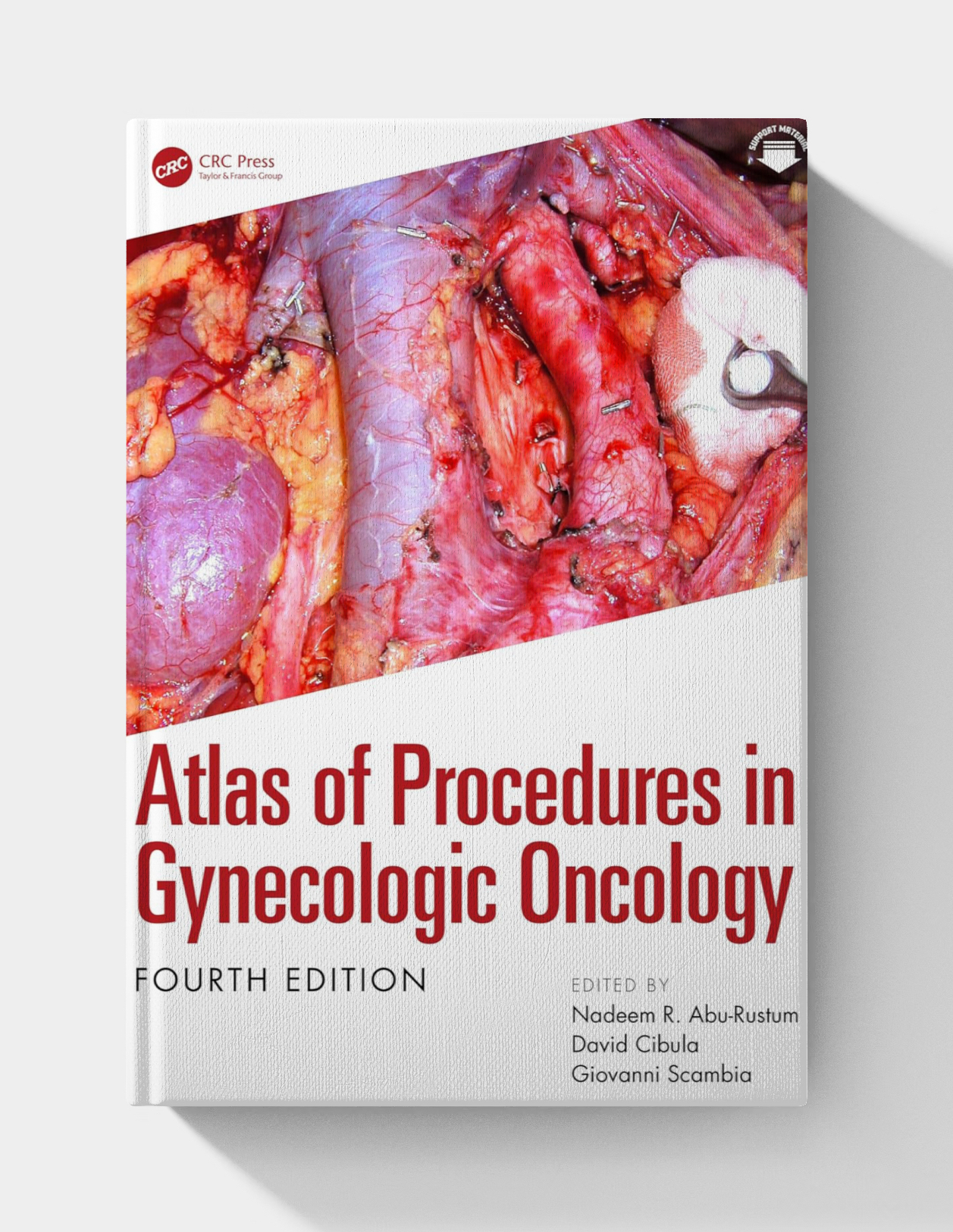 Atlas of Procedures in Gynecologic Oncology (4th Edition) 2026