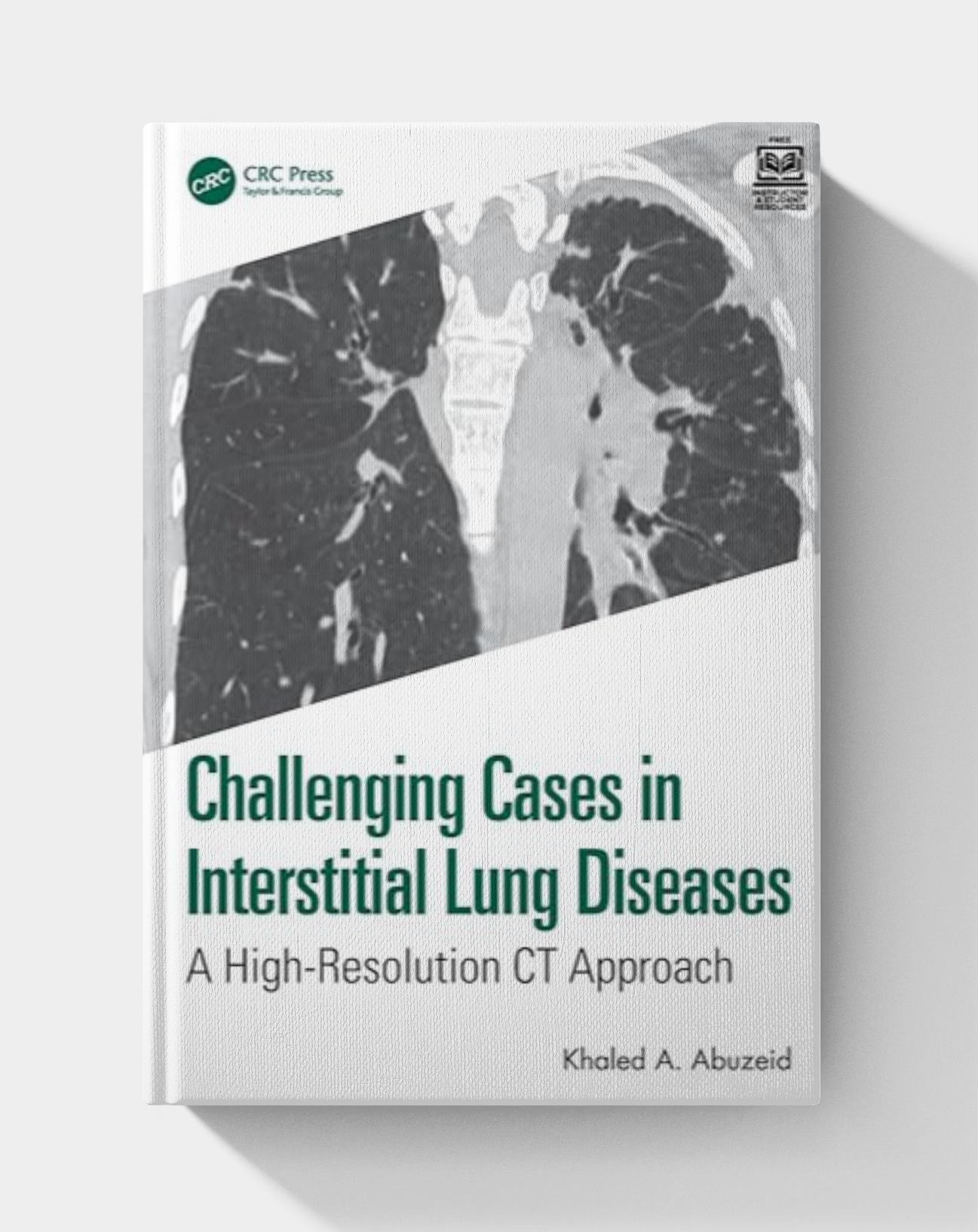 Challenging Cases in Interstitial Lung Diseases: A High-Resolution CT Approach Paperback (2025)
