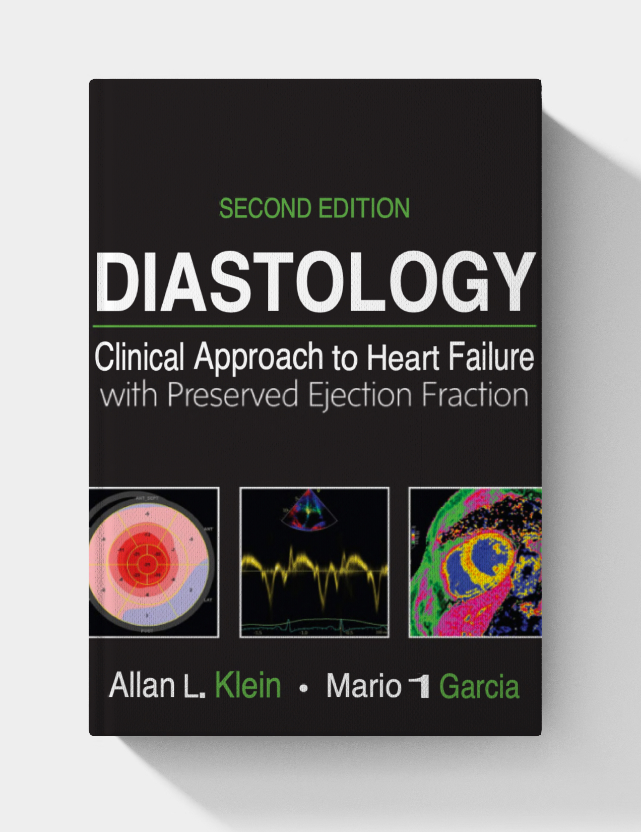 Diastology: Clinical Approach to Heart Failure with Preserved Ejection Fraction (2nd Edition) pdf only