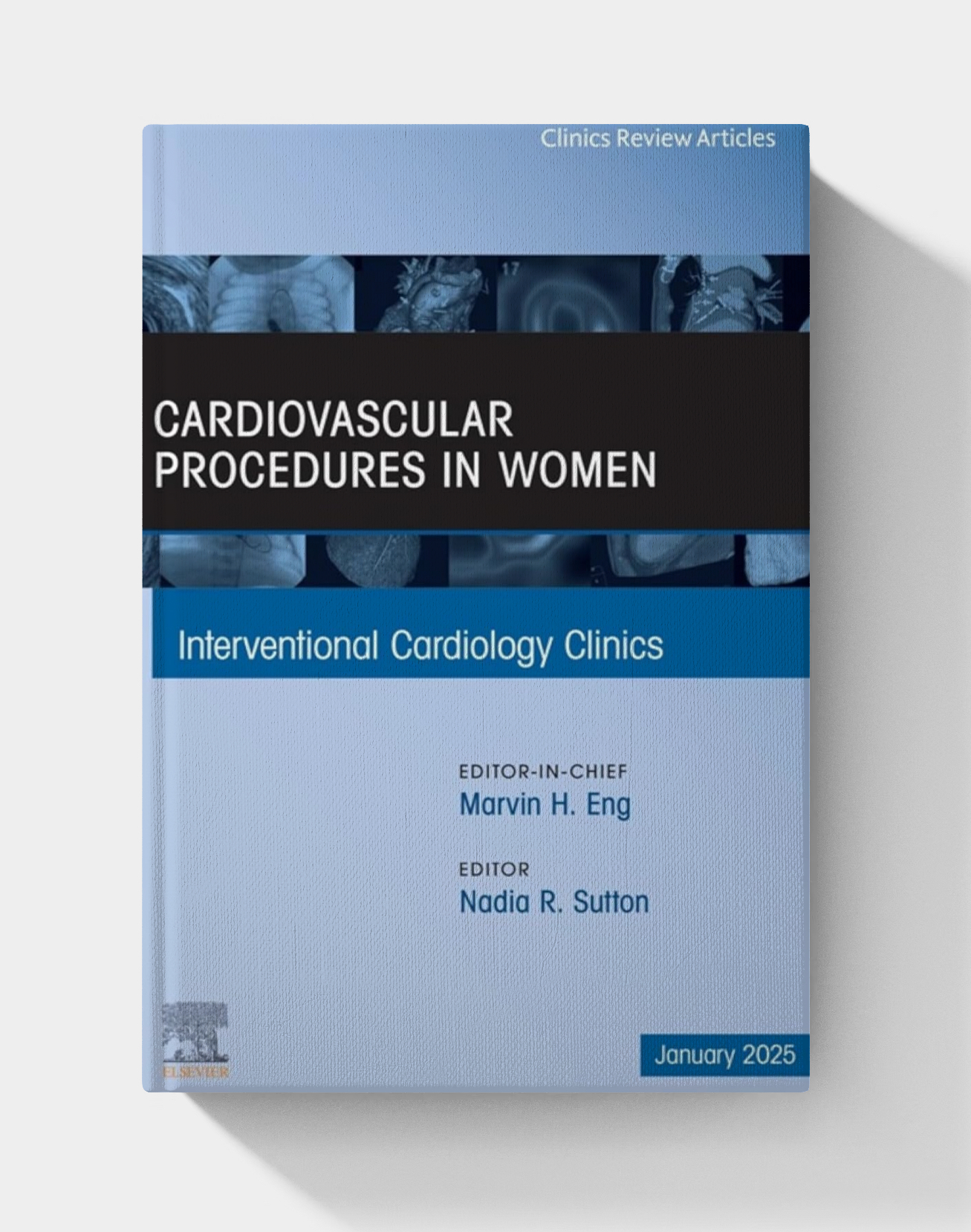 Cardiovascular Procedures in Women, An Issue of Interventional Cardiology Clinics (2025)