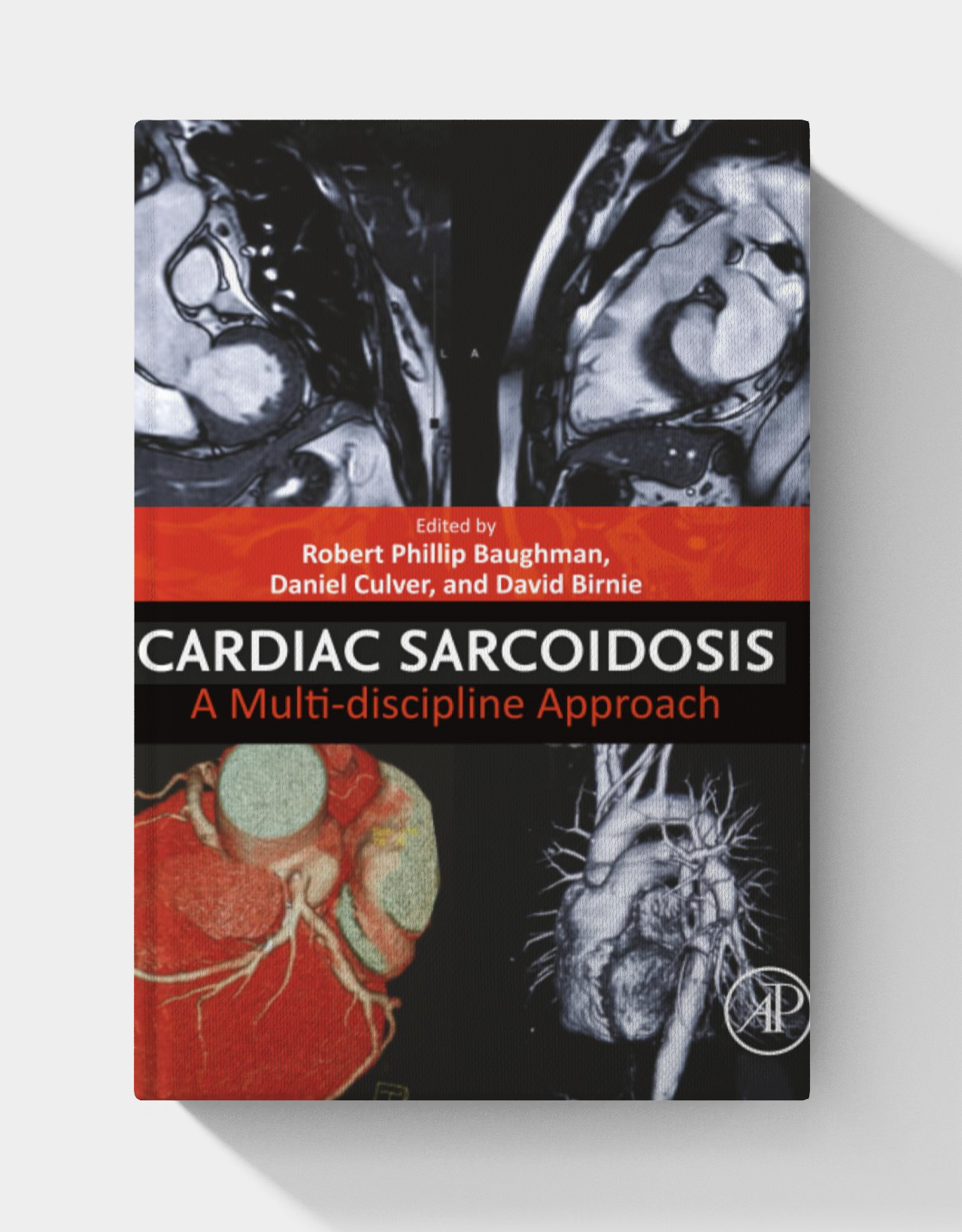 Cardiac Sarcoidosis: A Multi-discipline Approach (1st Edition)