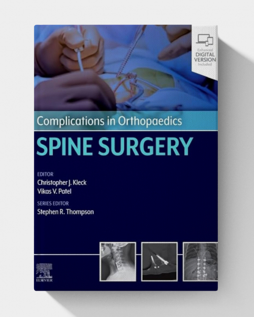 Complications in Orthopaedics: Spine Surgery