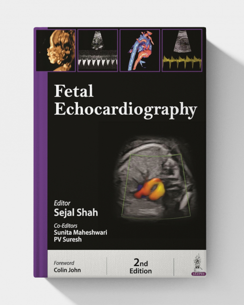 Fetal Echocardiography (2nd edition)