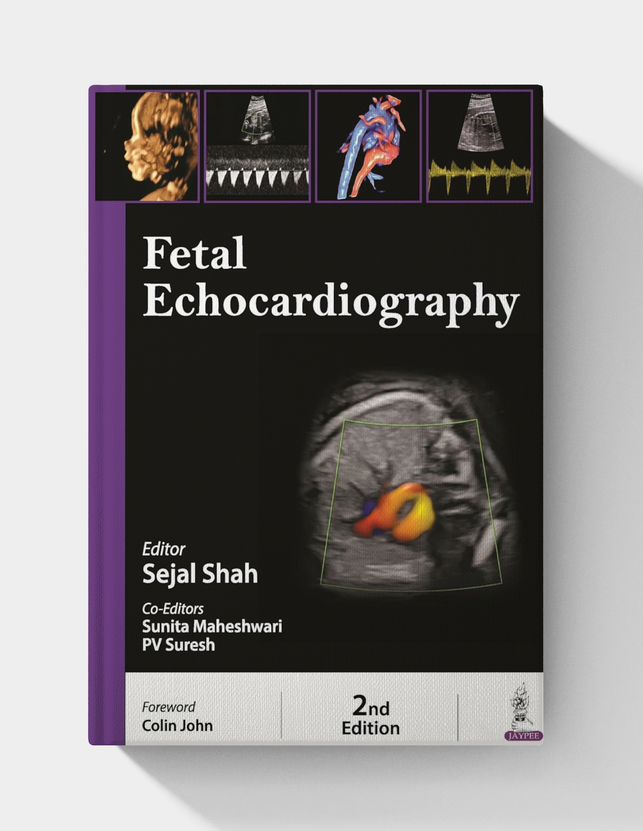Fetal Echocardiography (2nd edition)