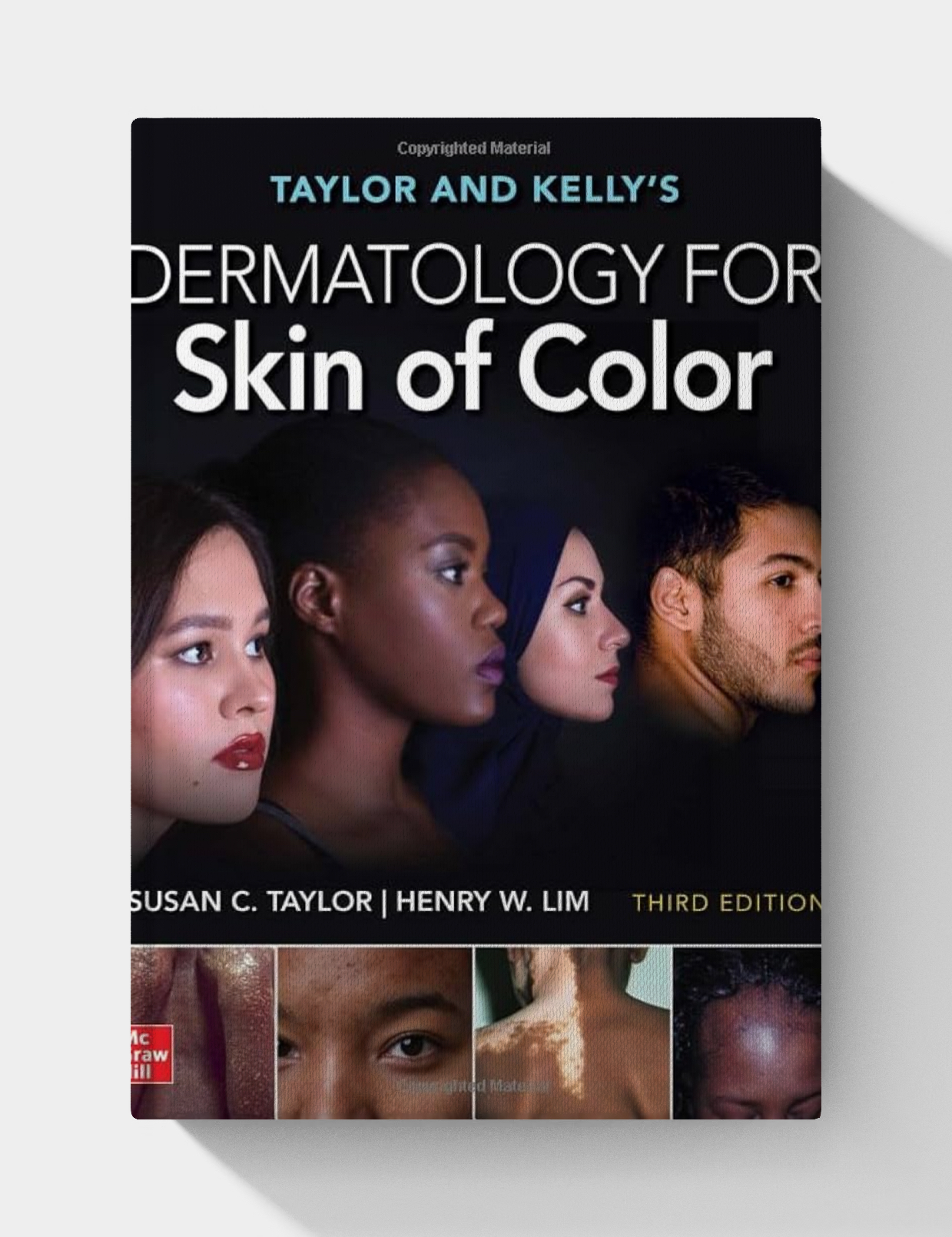 Taylor and Kelly’s Dermatology for Skin of Color (3rd Edition)