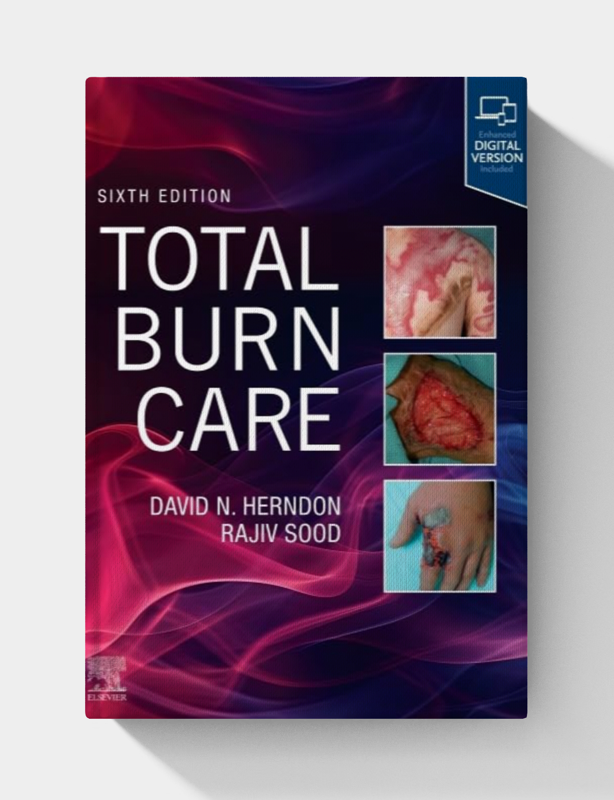 Total Burn Care (6th edition)