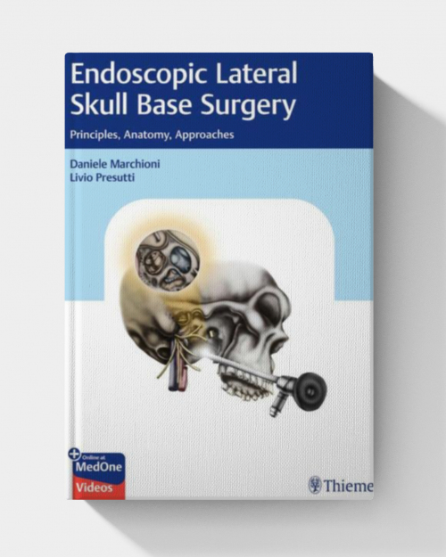 Endoscopic Lateral Skull Base Surgery: Principles, Anatomy, Approaches (PDF+Videos)