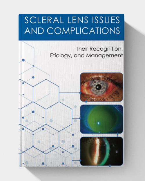 Scleral Lens Issues and Complications
