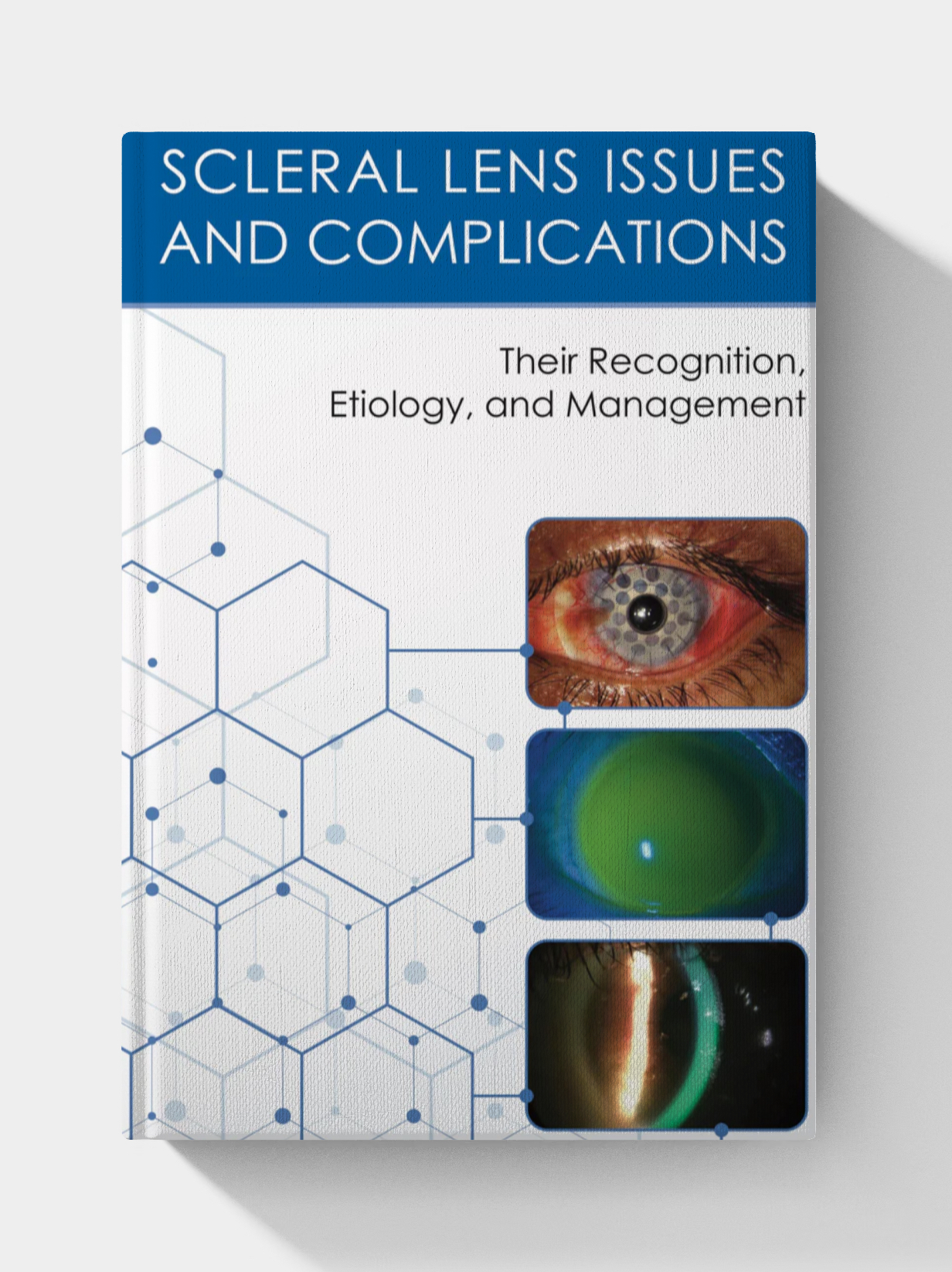 Scleral Lens Issues and Complications