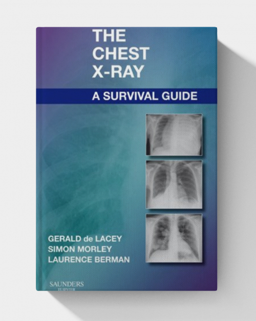 The Chest X-Ray: A Survival Guide (1st Edition)