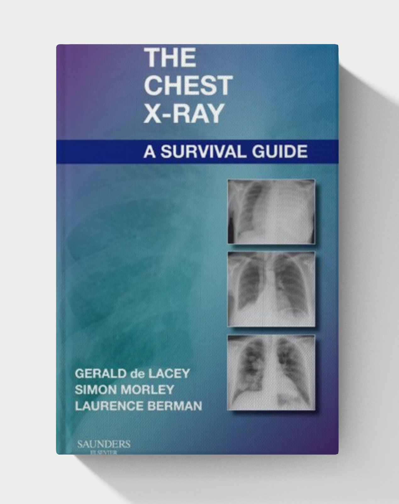 The Chest X-Ray: A Survival Guide (1st Edition)