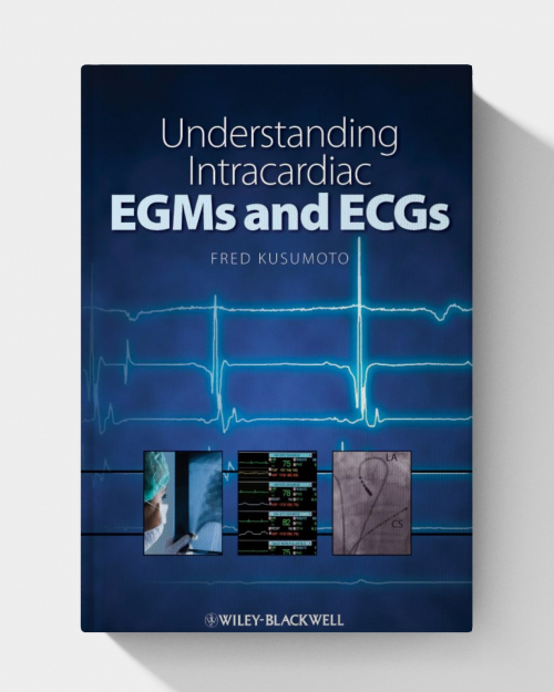 Understanding Intracardiac EGMs and ECGs (1st Edition)