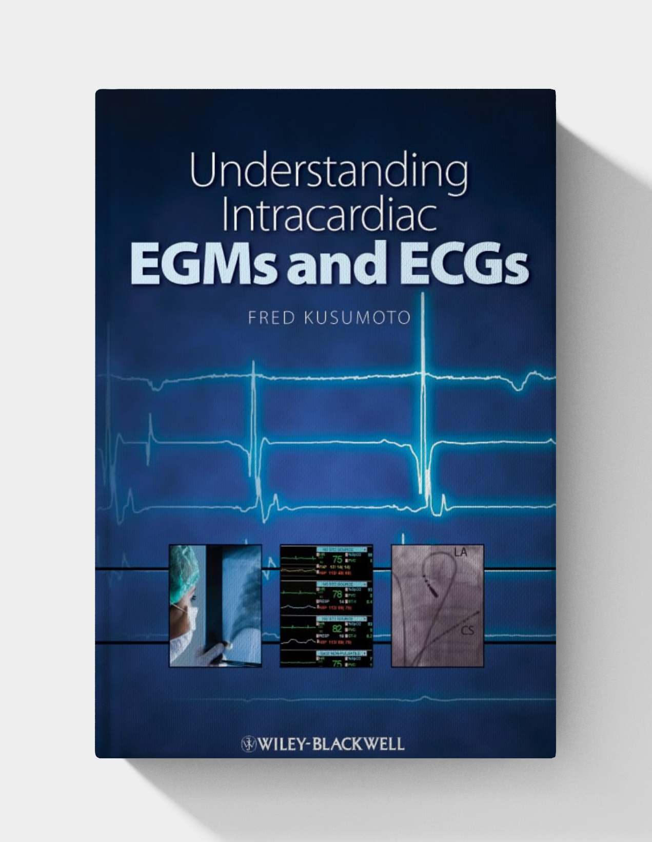 Understanding Intracardiac EGMs and ECGs (1st Edition)