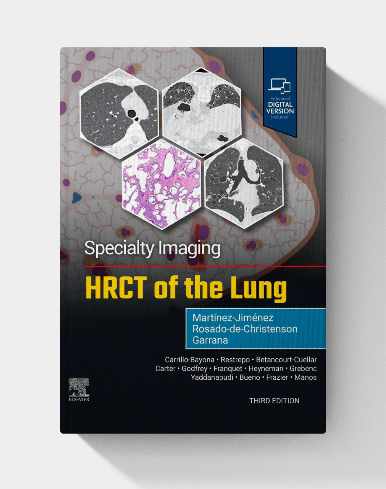 Specialty Imaging: HRCT of the Lung (3rd Edition)