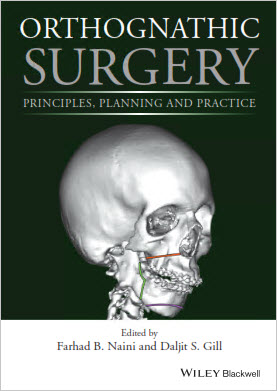 Orthognathic Surgery: Principles, Planning and Practice